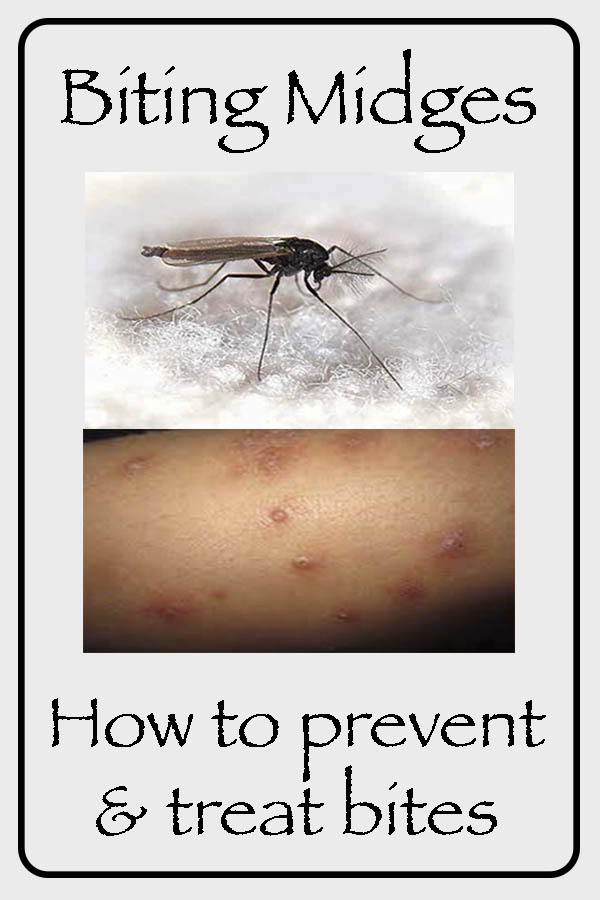 What To Put On Midge Bites